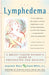 Lymphedema: A Breast Cancer Patient's Guide to Prevention and Healing by Jeannie Burt