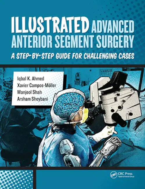 Illustrated Advanced Anterior Segment Surgery: A Step-By-Step Guide for Challenging Cases by Iqbal Ahmed