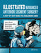 Illustrated Advanced Anterior Segment Surgery: A Step-By-Step Guide for Challenging Cases by Iqbal Ahmed