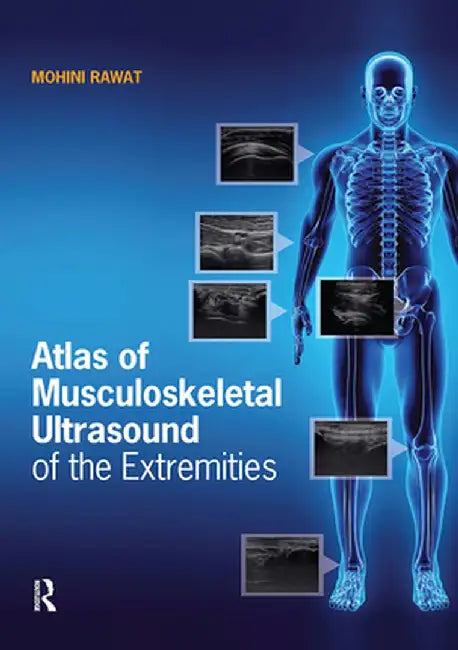 Atlas of Musculoskeletal Ultrasound of the Extremities by Mohini Rawat