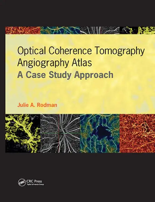 Optical Coherence Tomography Angiography Atlas: A Case Study Approach by Julie Rodman