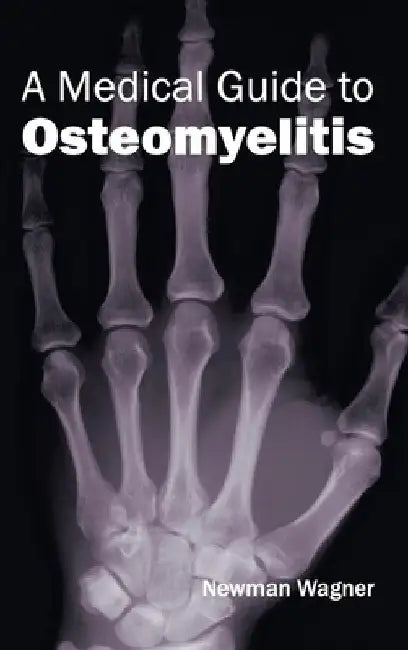 Medical Guide to Osteomyelitis by Newman Wagner