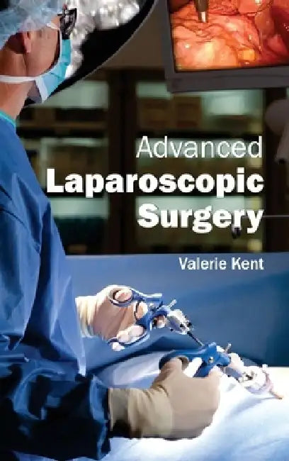 Advanced Laparoscopic Surgery by Valerie Kent
