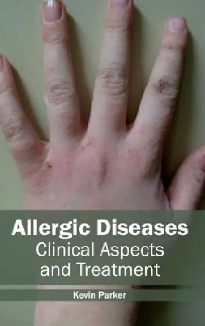 Allergic Diseases: Clinical Aspects and Treatment by Kevin Parker