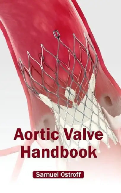 Aortic Valve Handbook by Samuel Ostroff