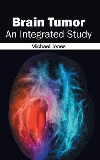 Brain Tumor: An Integrated Study by Michael Jones