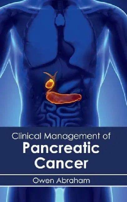 Clinical Management of Pancreatic Cancer by Owen Abraham