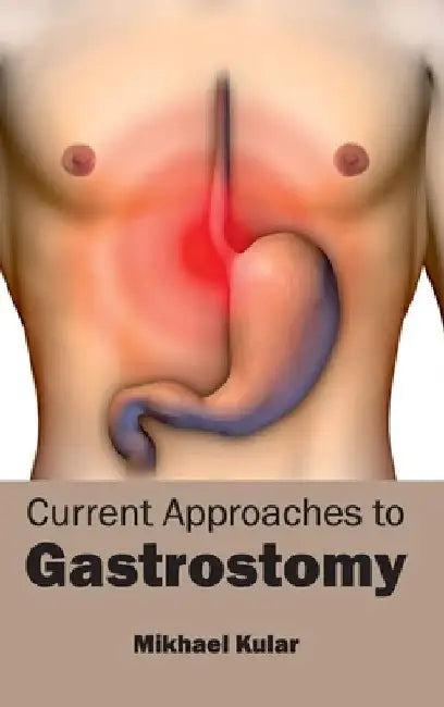 Current Approaches to Gastrostomy by Mikhael Kular