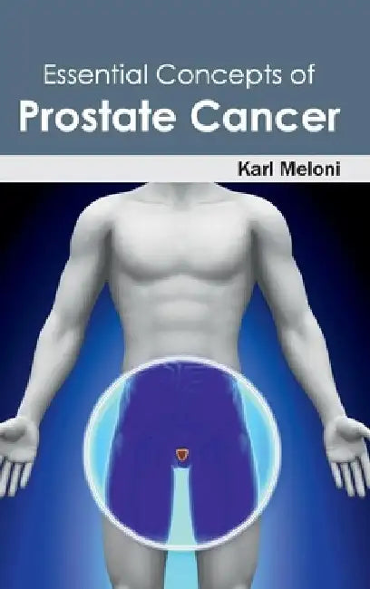 Essential Concepts of Prostate Cancer by Karl Meloni