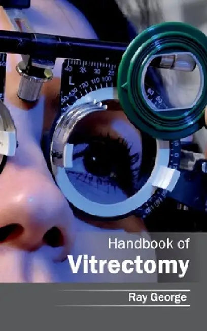 Handbook of Vitrectomy by Ray George
