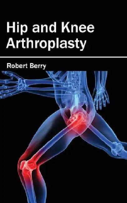 Hip and Knee Arthroplasty by Robert Berry