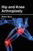 Hip and Knee Arthroplasty by Robert Berry