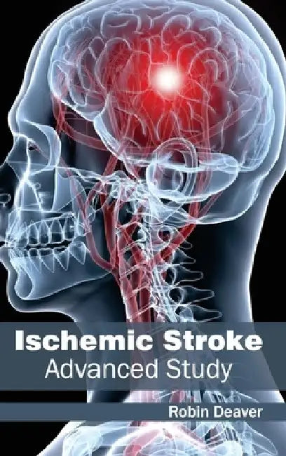 Ischemic Stroke: Advanced Study by Robin Deaver