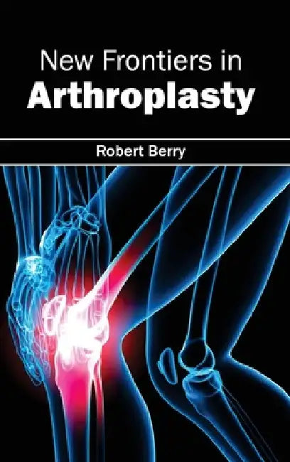 New Frontiers in Arthroplasty by Robert Berry