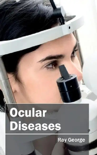 Ocular Diseases by Ray George