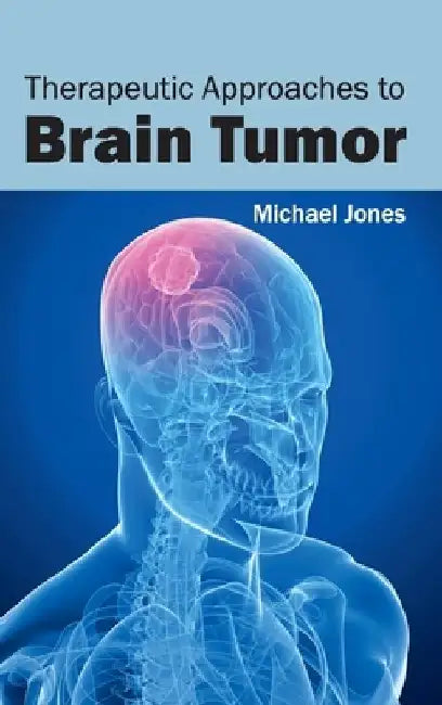 Therapeutic Approaches to Brain Tumor by Michael Jones