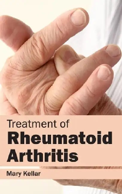 Treatment of Rheumatoid Arthritis by Mary Kellar
