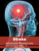 Stroke: Advanced Researches by Robin Deaver