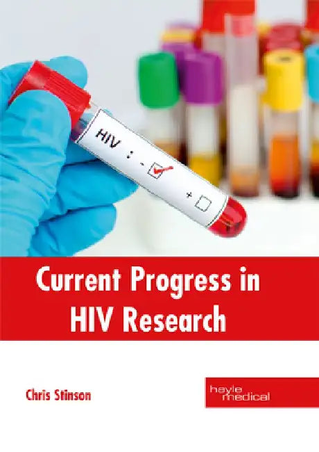 Current Progress in HIV Research by Chris Stinson