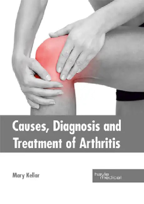 Causes, Diagnosis and Treatment of Arthritis by Mary Kellar
