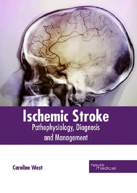 Ischemic Stroke: Pathophysiology, Diagnosis and Management by Caroline West