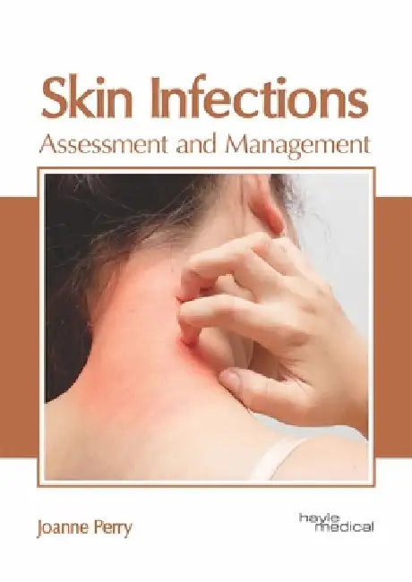 Skin Infections: Assessment and Management by Joanne Perry