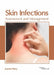 Skin Infections: Assessment and Management by Joanne Perry