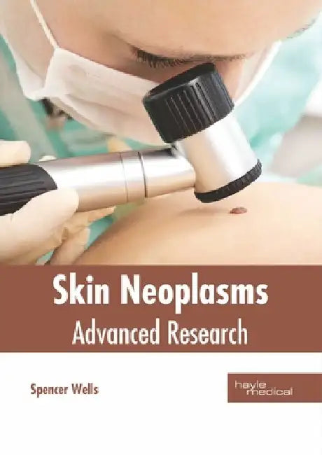 Skin Neoplasms: Advanced Research by Spencer Wells