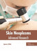 Skin Neoplasms: Advanced Research by Spencer Wells