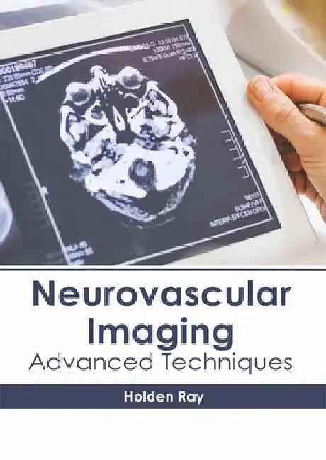 Neurovascular Imaging: Advanced Techniques by Holden Ray