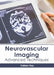 Neurovascular Imaging: Advanced Techniques by Holden Ray
