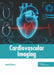 Cardiovascular Imaging by Jared Peters