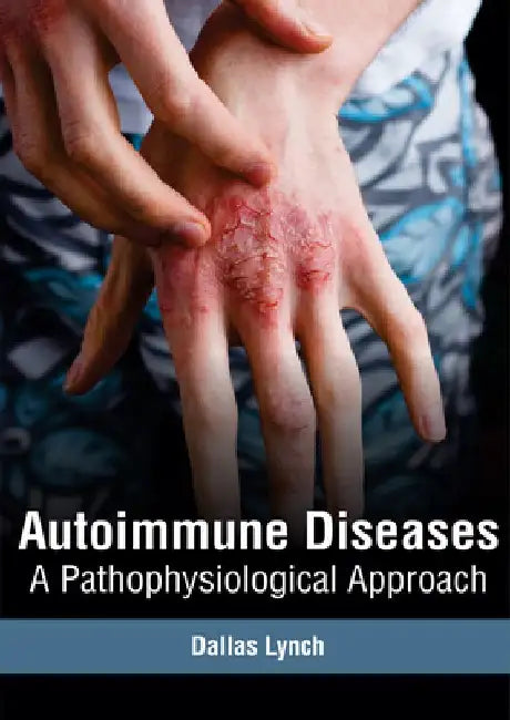 Autoimmune Diseases: A Pathophysiological Approach by Dallas Lynch