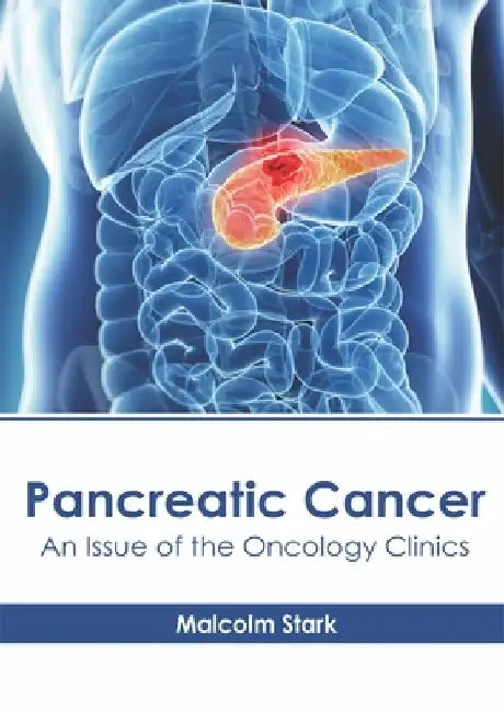 Pancreatic Cancer: An Issue of the Oncology Clinics by Malcolm Stark