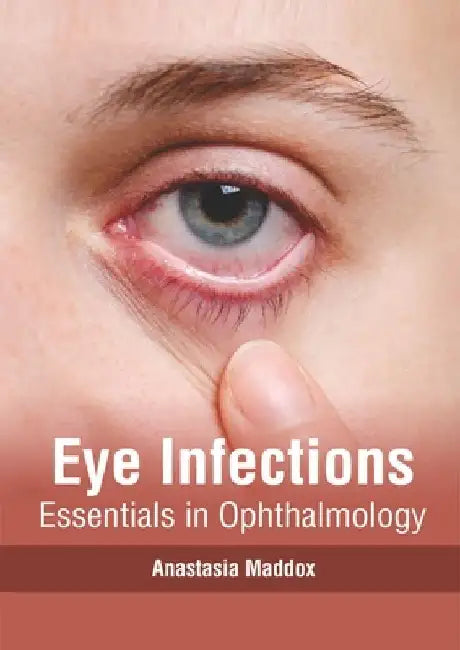 Eye Infections: Essentials in Ophthalmology by Anastasia Maddox