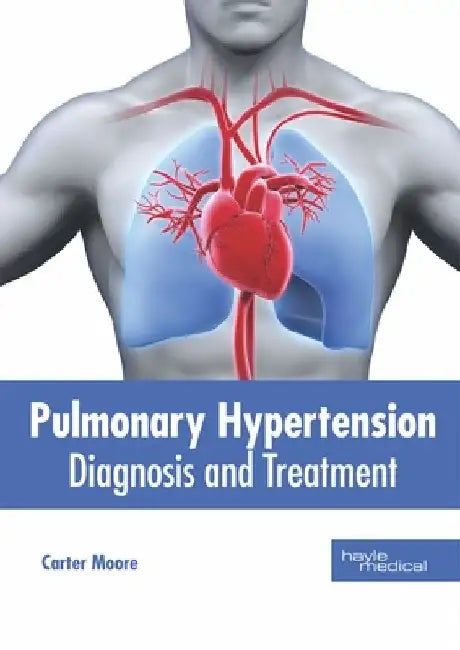 Pulmonary Hypertension: Diagnosis and Treatment by Carter Moore