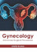Gynecology: Advanced Surgical Procedures by Juliette Brookes