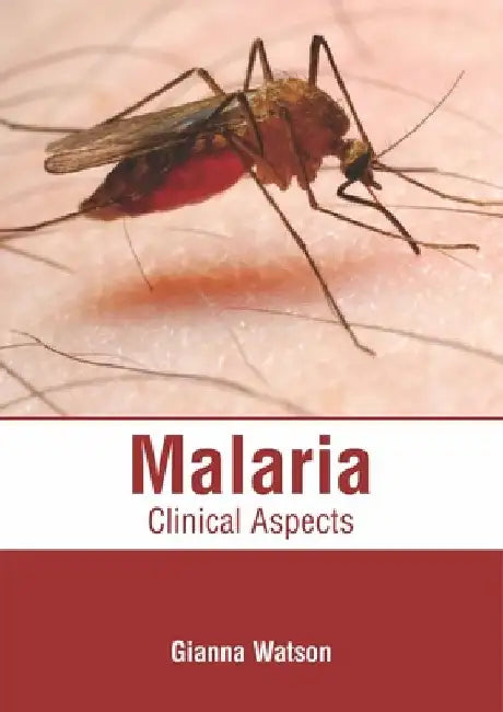 Malaria: Clinical Aspects by Gianna Watson