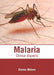 Malaria: Clinical Aspects by Gianna Watson