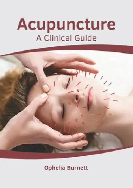 Acupuncture: A Clinical Guide by Ophelia Burnett