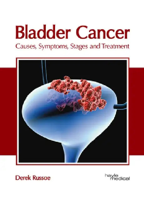 Bladder Cancer: Causes, Symptoms, Stages and Treatment by Derek Russoe