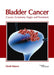 Bladder Cancer: Causes, Symptoms, Stages and Treatment by Derek Russoe