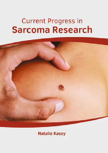 Current Progress in Sarcoma Research by Natalie Kasey