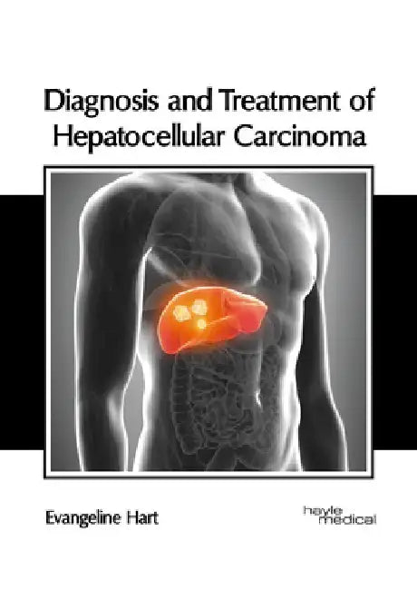 Diagnosis and Treatment of Hepatocellular Carcinoma by Evangeline Hart