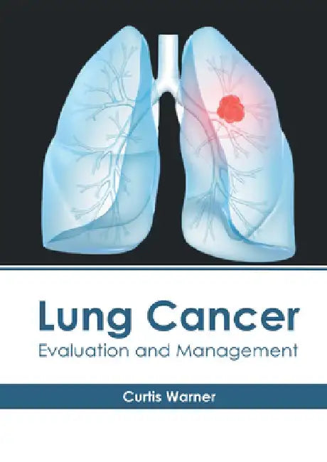 Lung Cancer: Evaluation and Management by Curtis Warner