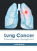 Lung Cancer: Evaluation and Management by Curtis Warner