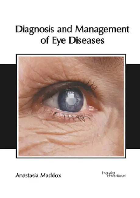 Diagnosis and Management of Eye Diseases by Anastasia Maddox