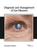 Diagnosis and Management of Eye Diseases by Anastasia Maddox