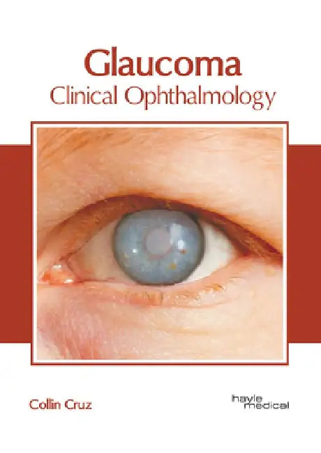 Glaucoma: Clinical Ophthalmology by Collin Cruz