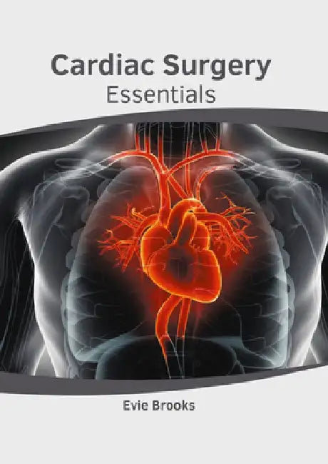 Cardiac Surgery Essentials by Evie Brooks